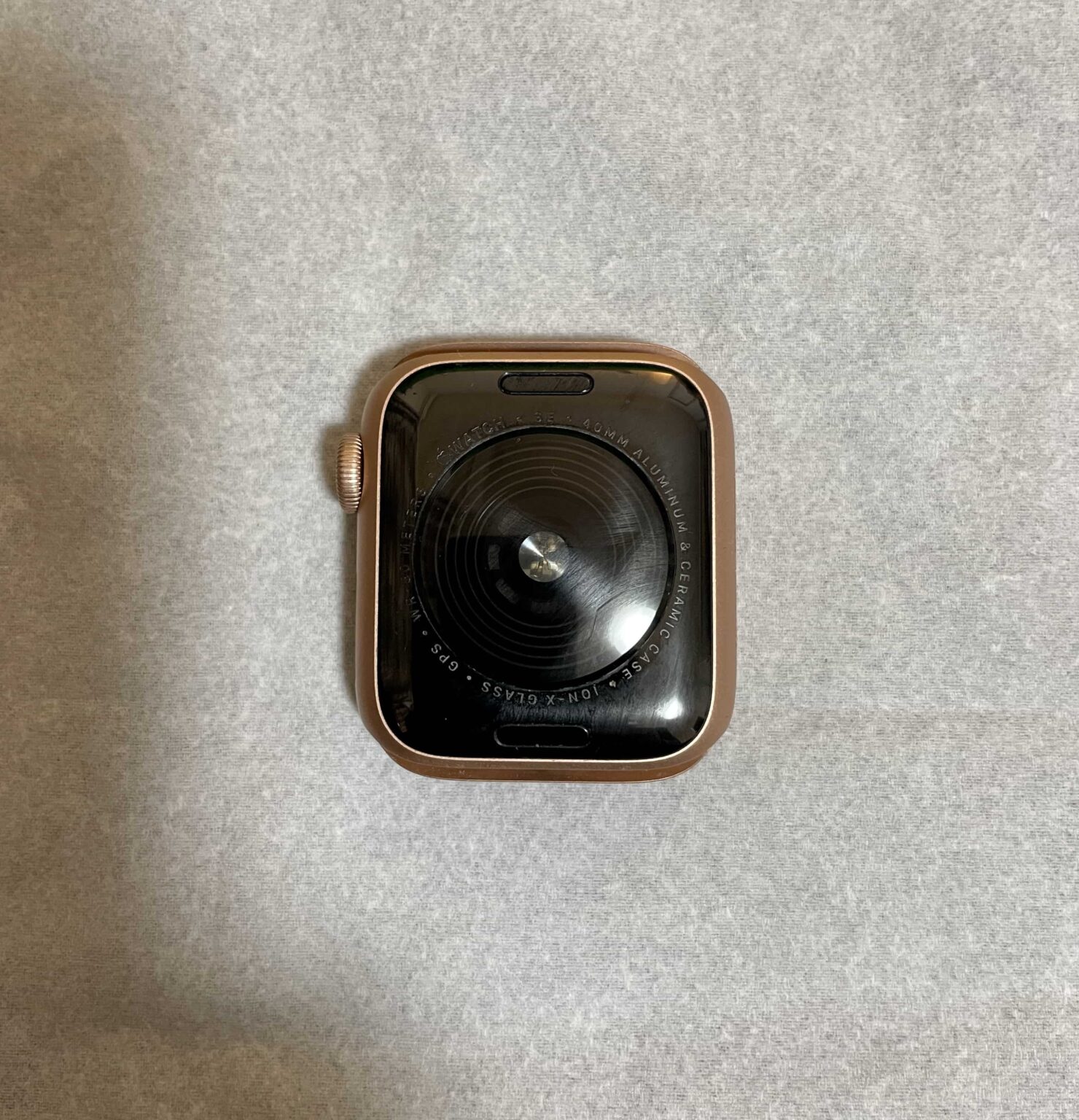 使用歴3年目の僕のApple Watch金属アレルギー対策（おすすめバンド） ゴーゴーシンゴのブログ