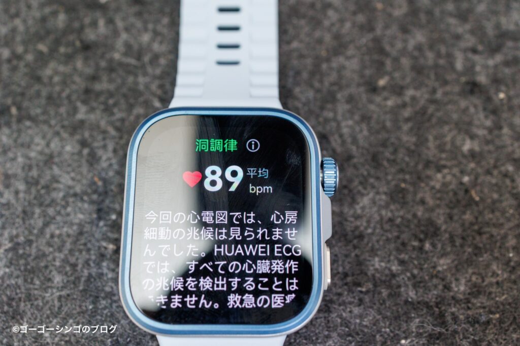 Huawei WATCH FIT 4 Proの心電図
