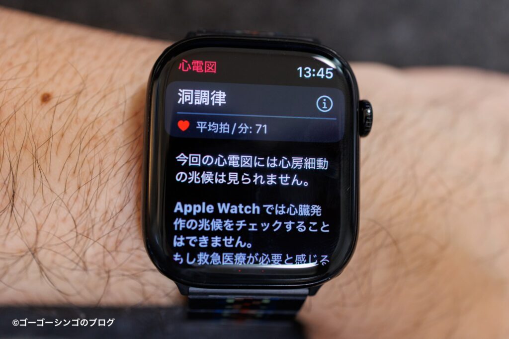 Apple Watchシリーズ10ジェットブラックの心電図
