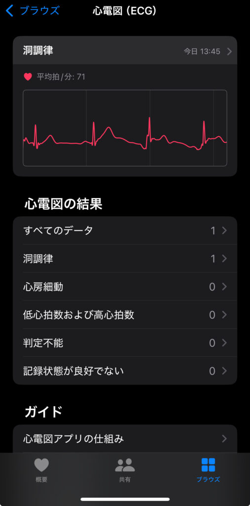Apple Watchシリーズ10ジェットブラックの心電図
